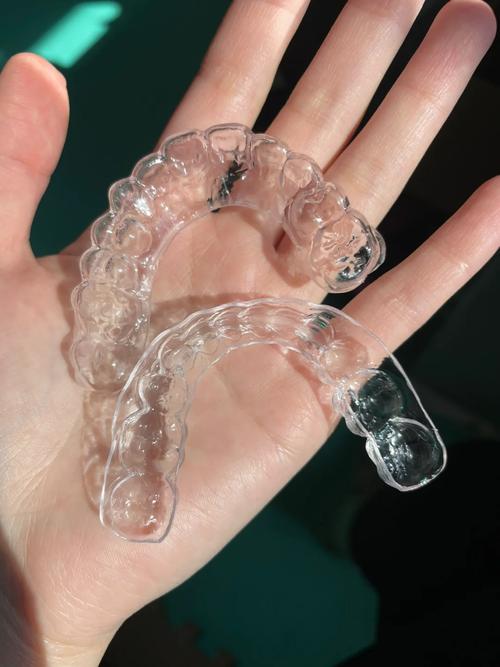 正畸保持器图片大全-图1