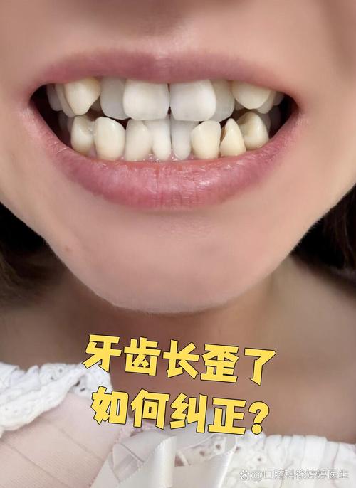 牙根歪了能做正畸吗-图1