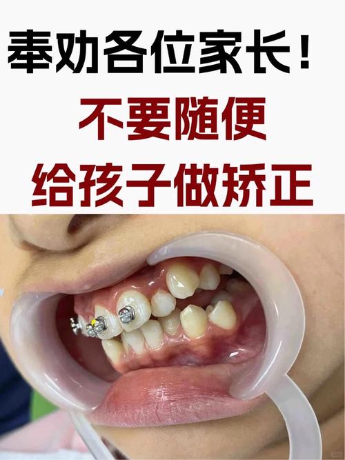 想要辞职去进修正畸-图3