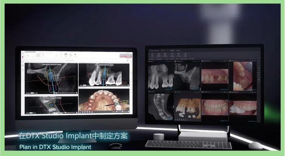 种牙系统有哪些-图1