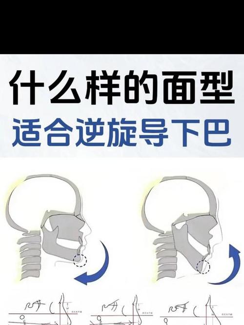 正畸逆时针旋转下巴-图1