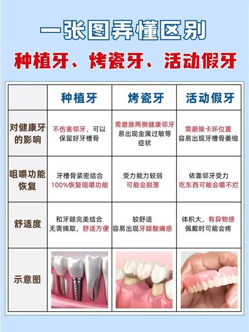 种牙与镶牙区别-图3