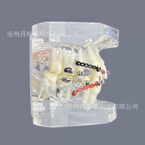 正畸牙模一般多少钱？-图3