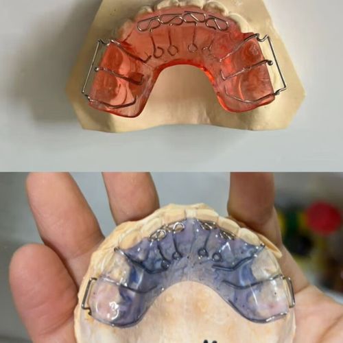 正畸推簧的正当使用究竟指什么？如何规范操作？-图2