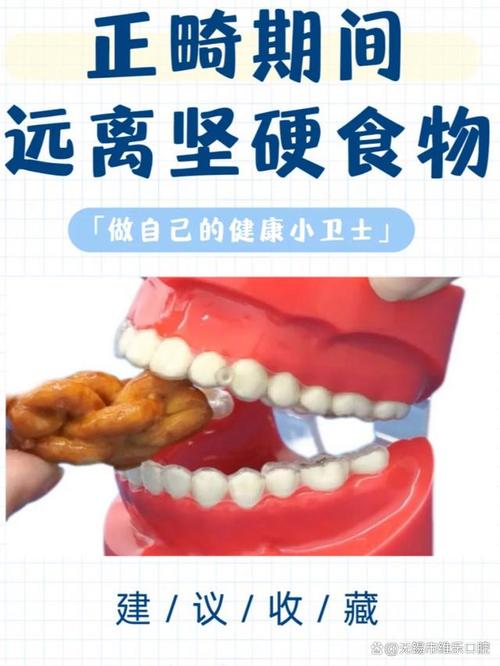 正畸牙时期,哪些食物能吃又不会伤牙矫正?-图2 正畸牙时期,哪些食物能吃又不会伤牙矫正?-图2