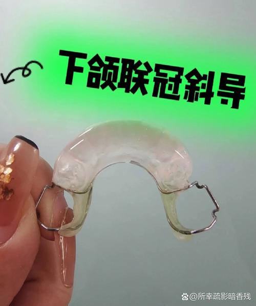 正畸为什么要戴斜导？它对牙齿矫正有何关键作用？-图2