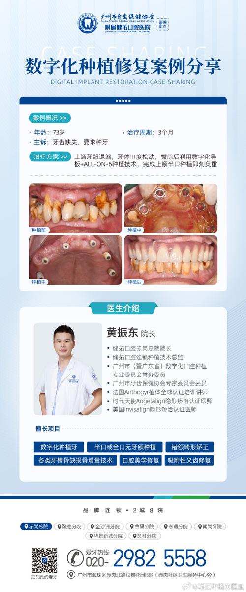 广州种牙哪家好-图1