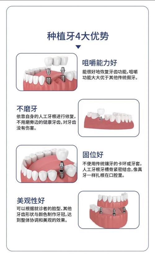 哪里种牙比较好-图2