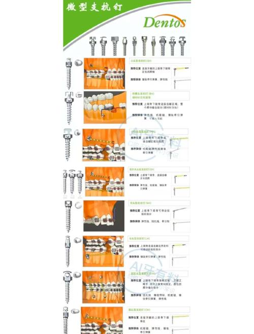 正畸支抗钉取钉疼吗？具体步骤和注意事项有哪些？-图3