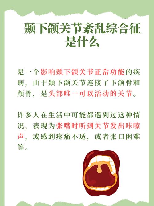 颞下颌关节弹响正畸-图2