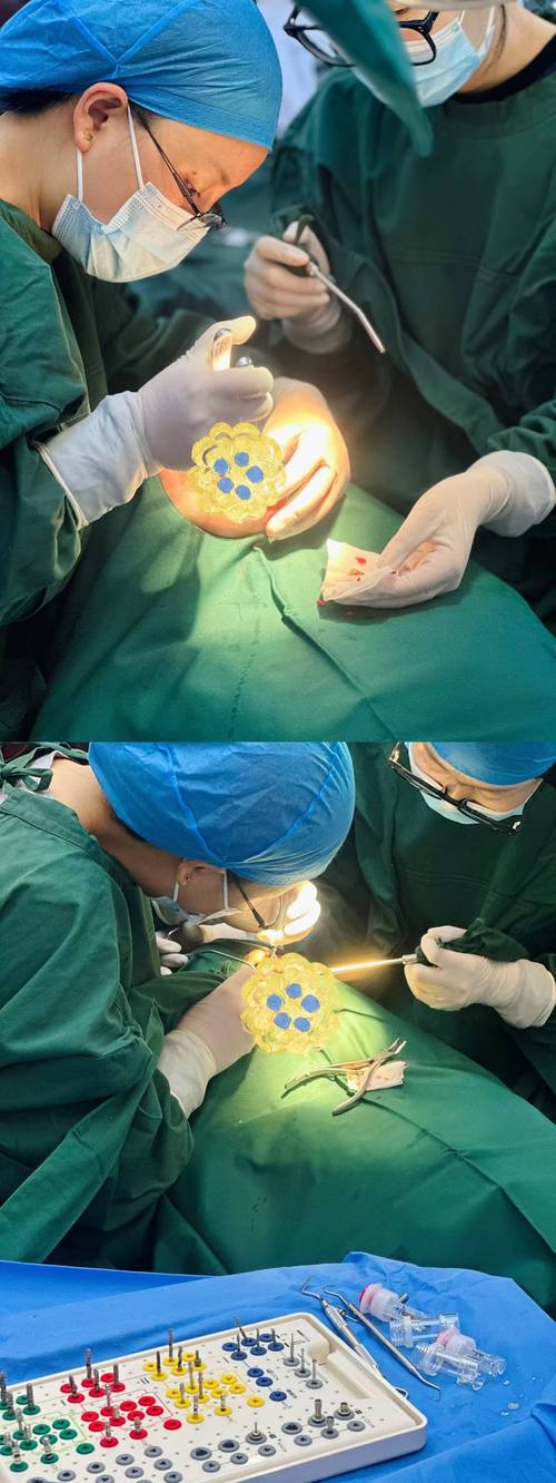 上牙即拔即种效果如何？安全性和适用人群有哪些？-图3