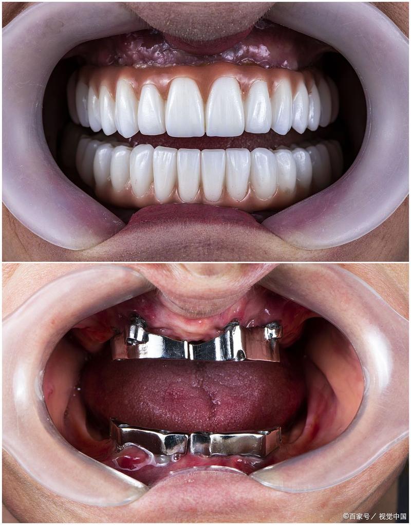 南京市种稙牙-图3