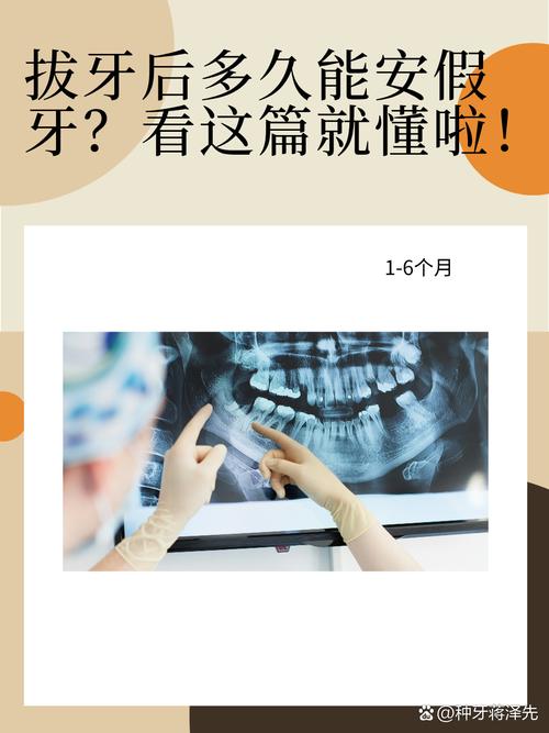 拔牙正畸要安假牙吗-图3