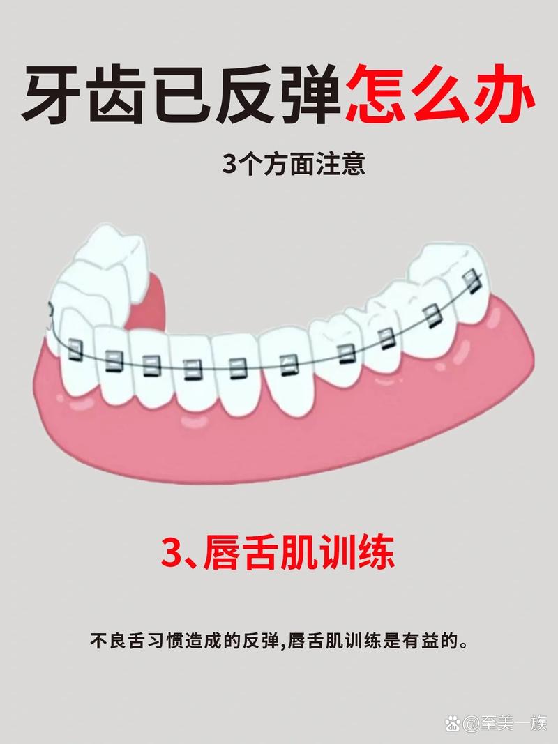 正畸牙后怎么防反弹-图1