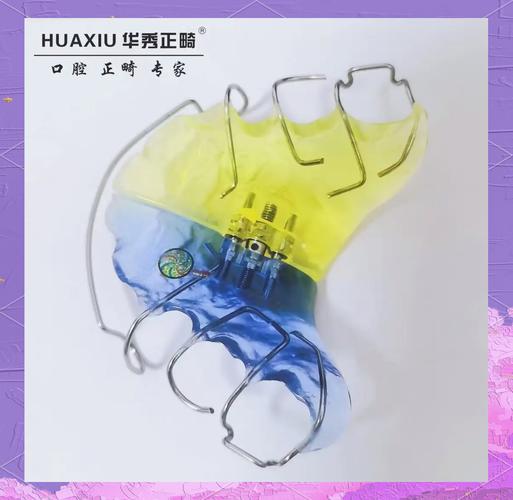 正畸快速扩弓器图片-图2