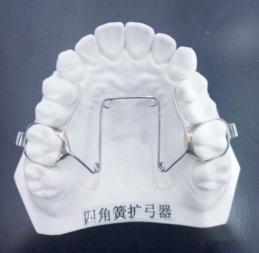 正畸快速扩弓器图片-图1