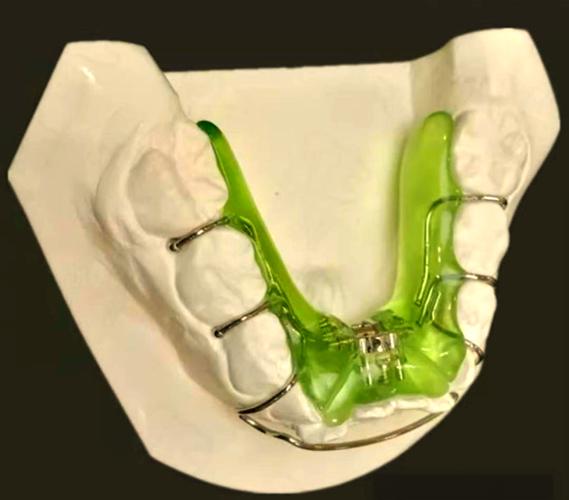 正畸快速扩弓器图片-图3
