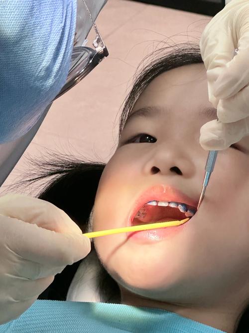 南京童盺种牙-图2 南京童盺种牙-图2