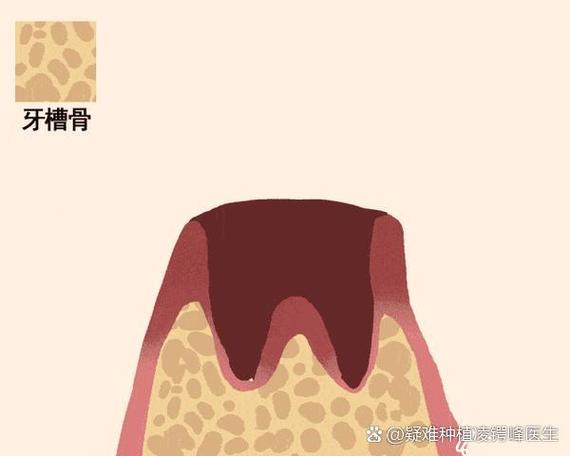 母亲节 种牙-图2