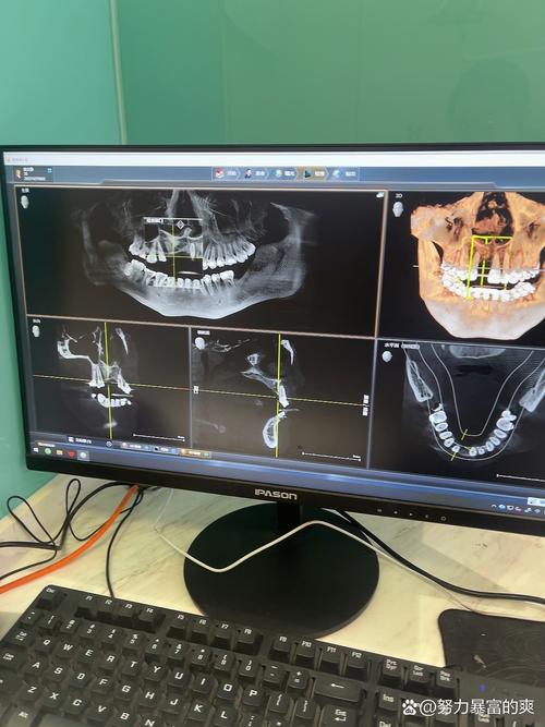 我种的牙用了-图2