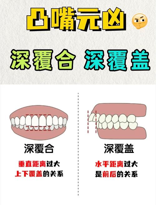 正畸深覆颌如何调整-图2