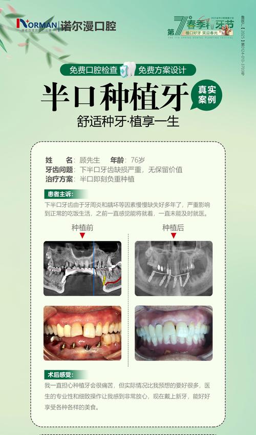 全口种牙帖子-图3
