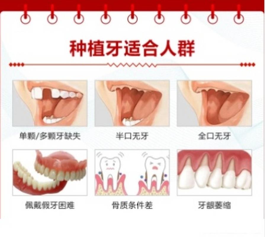种牙用麻醉吗-图2