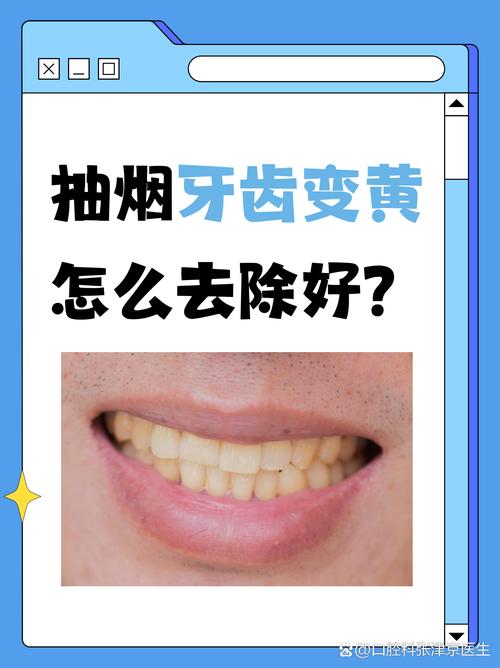 吸烟会影响种牙效果吗？-图3