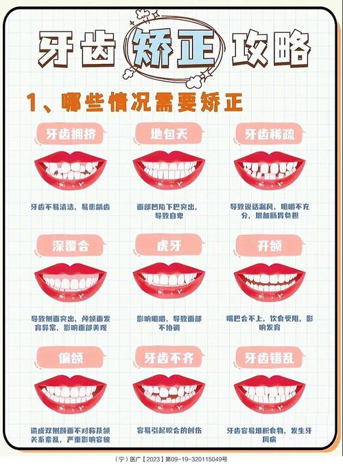 包牙有多少种-图1