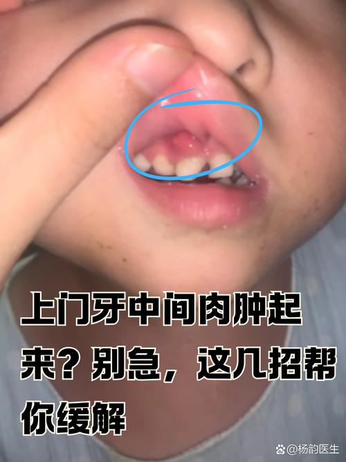 种牙肿的很大-图3