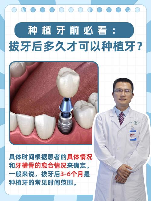 种牙前为何要拔牙？拔牙后多久适合种牙？-图1