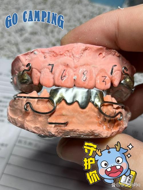 牙科正畸前方牵引器-图2