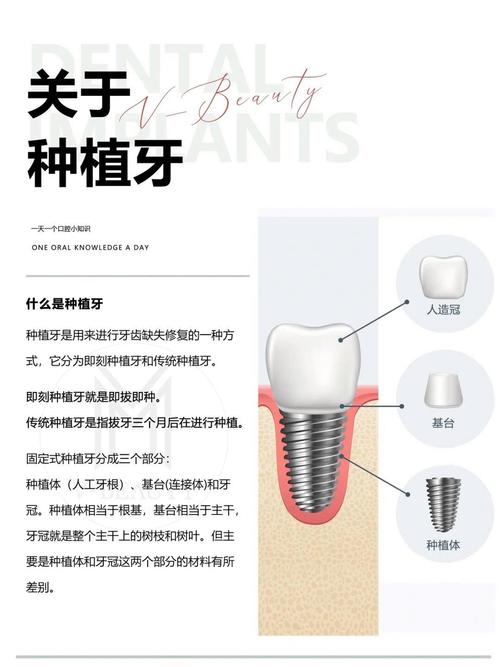 种牙又叫什么-图1 种牙又叫什么-图1