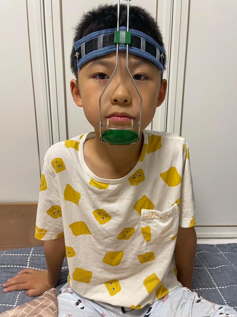 正畸弹簧断了怎么办-图2