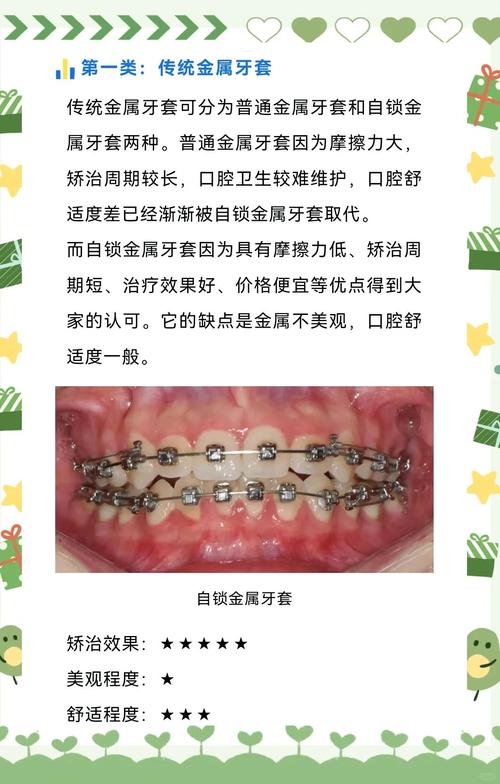 正畸对牙床有影响吗-图2 正畸对牙床有影响吗-图2