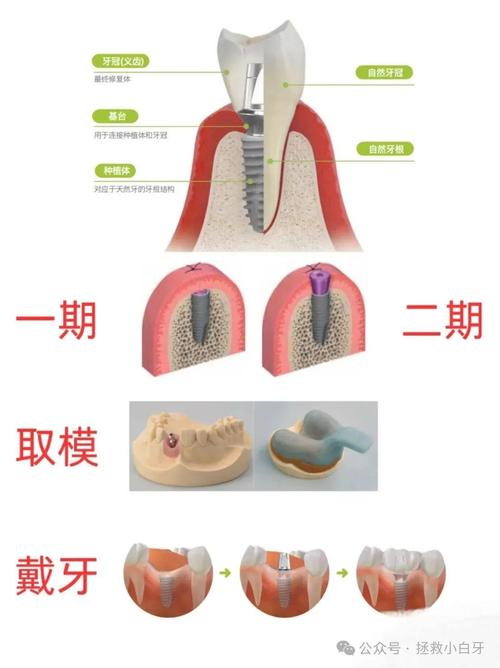 全口种牙害处-图2
