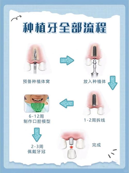 种义牙的条件-图1