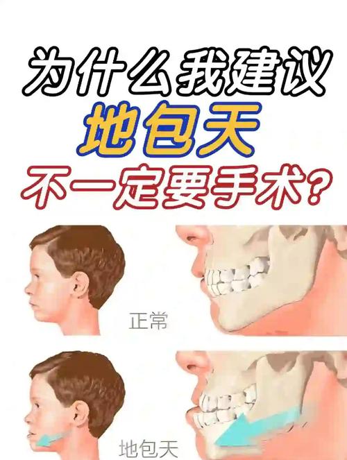 骨性地包天只做正畸，真的不用手术吗？-图3