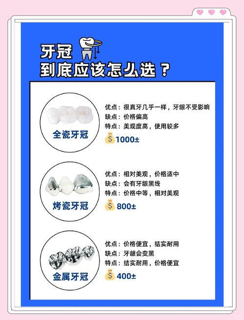种牙用哪种冠好?材质、价格、美观度如何权衡?-图3 种牙用哪种冠好?材质、价格、美观度如何权衡?-图3