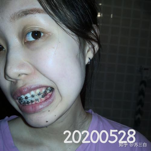 上海口腔防治院正畸-图2