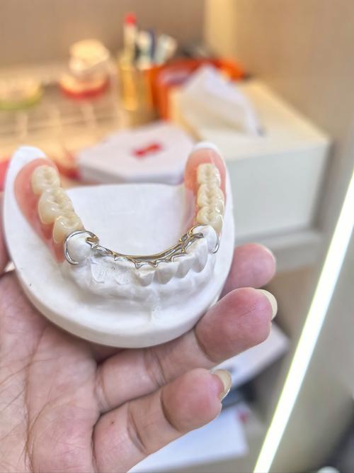 国外种牙价格贵吗？-图3