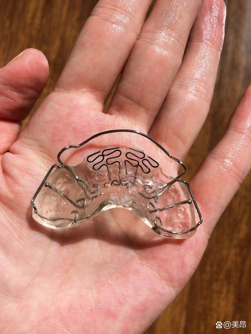 口外正畸牵引器图片能展示哪些关键结构?-图3 口外正畸牵引器图片能展示哪些关键结构?-图3