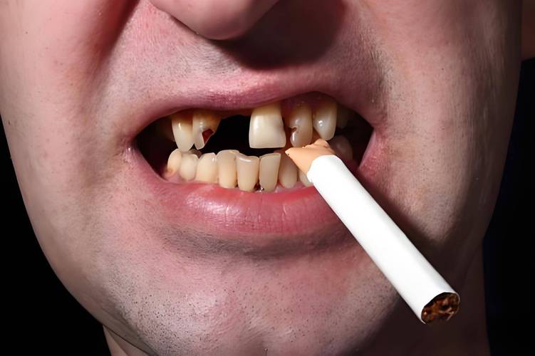 种牙能吸烟么-图1