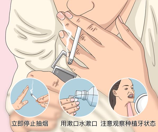 种牙能吸烟么-图2