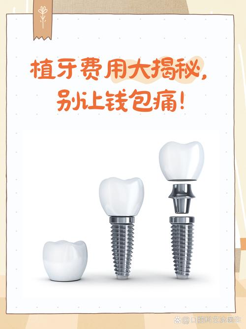 种3颗牙费用-图1