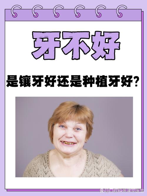 不镶牙不种牙-图3