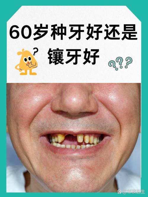 不镶牙不种牙-图2