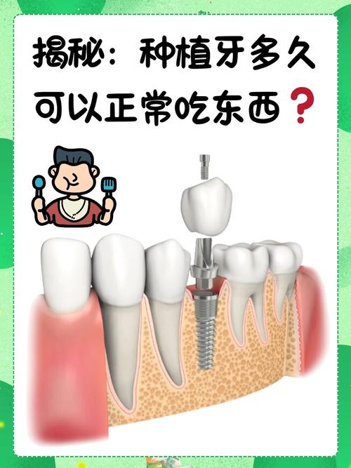 种牙甲乙丙是什么？三类有何区别？该怎么选？-图2