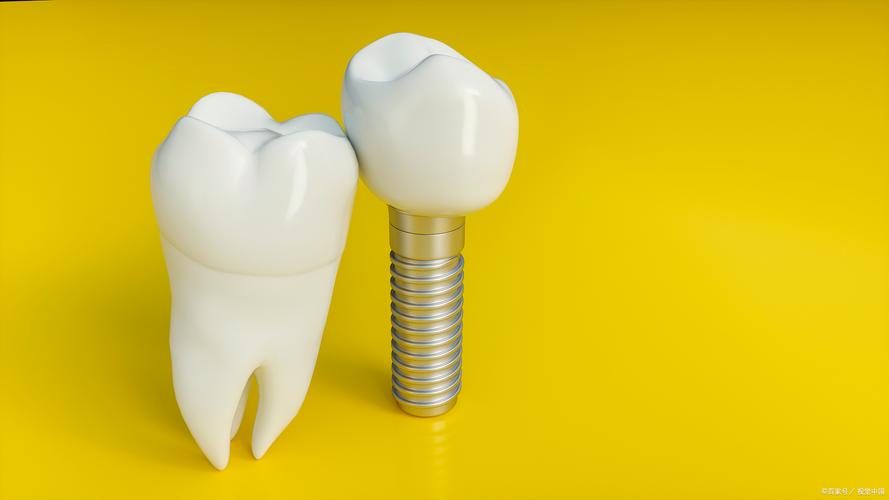 种牙难度大吗-图3