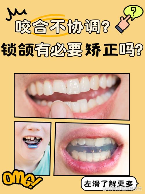 正畸会影响鄂关节吗-图1